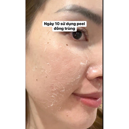 Huyen Phi Cordyceps Skin Peel