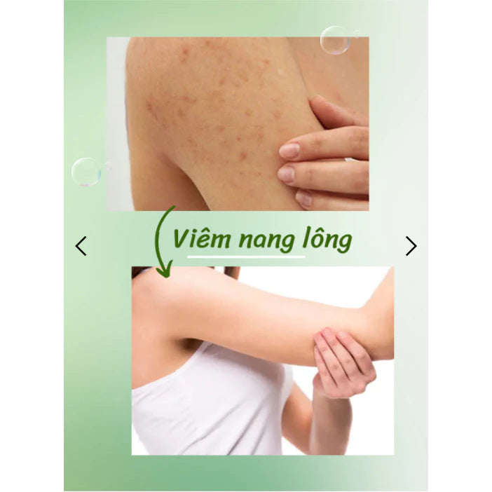 Aloe Xera Gel Exfoliating Aloe Vera Shrinks Pores