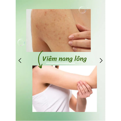Aloe Xera Gel Exfoliating Aloe Vera Shrinks Pores