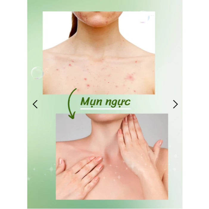 Aloe Xera Gel Exfoliating Aloe Vera Shrinks Pores