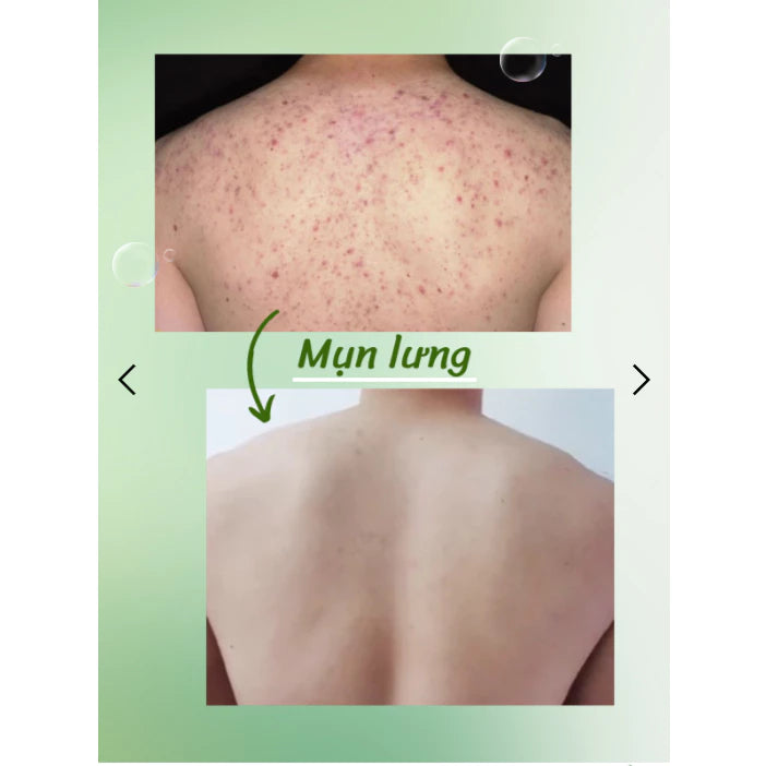 Aloe Xera Gel Exfoliating Aloe Vera Shrinks Pores