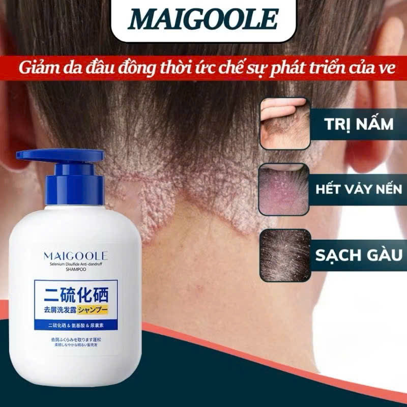 Dau Goi Nam - Maigoole herbal anti-fungal shampoo – relieves itch, soothes scalp, reduces fungal dandruff.